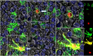 Production of SARS-CoV (red) after infected monocytes (green) reached lymph nodes and differentiated into dendritic cells (yellow).